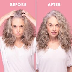 Umberto Giannini Anti-Dandruff Saç Derisini Yenileyen Kepek Önleyici Kuru Şampuan 200 ML